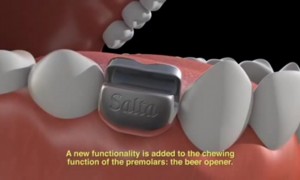 Beer Tooth Implant